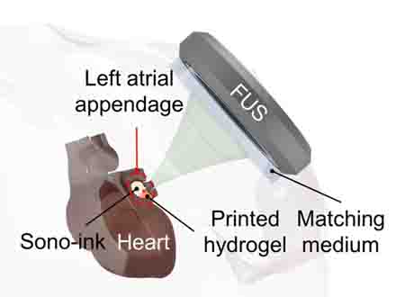 《Science》 利用超声波技术在猪体内可实现深层3D打印